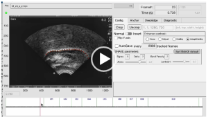 ISRL projects featured by Acoustical Society of America